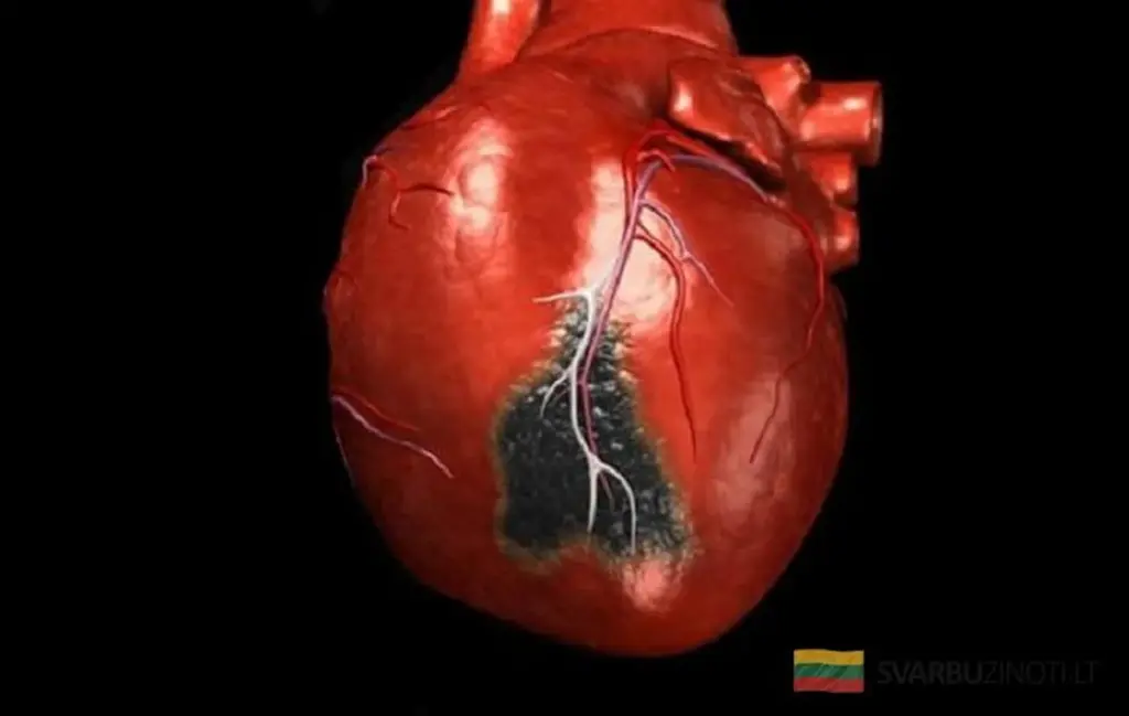 7 señales de infarto que exigen llamar a emergencias YA