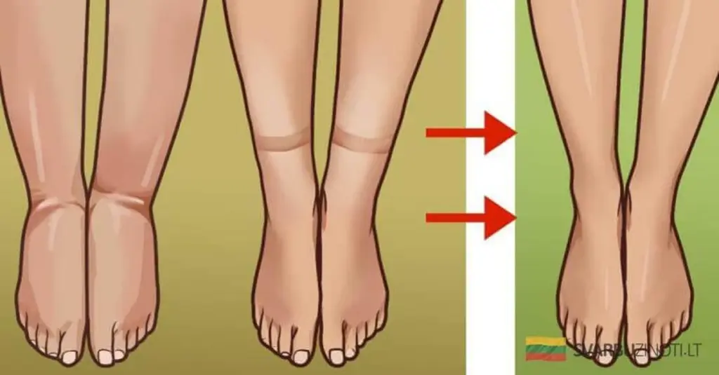 El secreto de la abuela para deshinchar el vientre y limpiar tus arterias