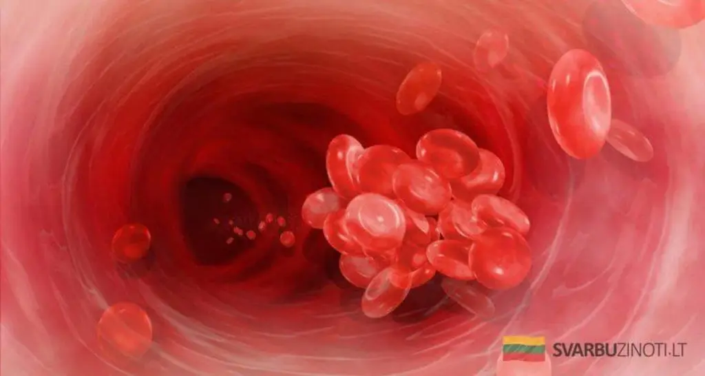 Por qué una cucharada de canela al día puede doblar el riesgo de coágulos sanguíneos
