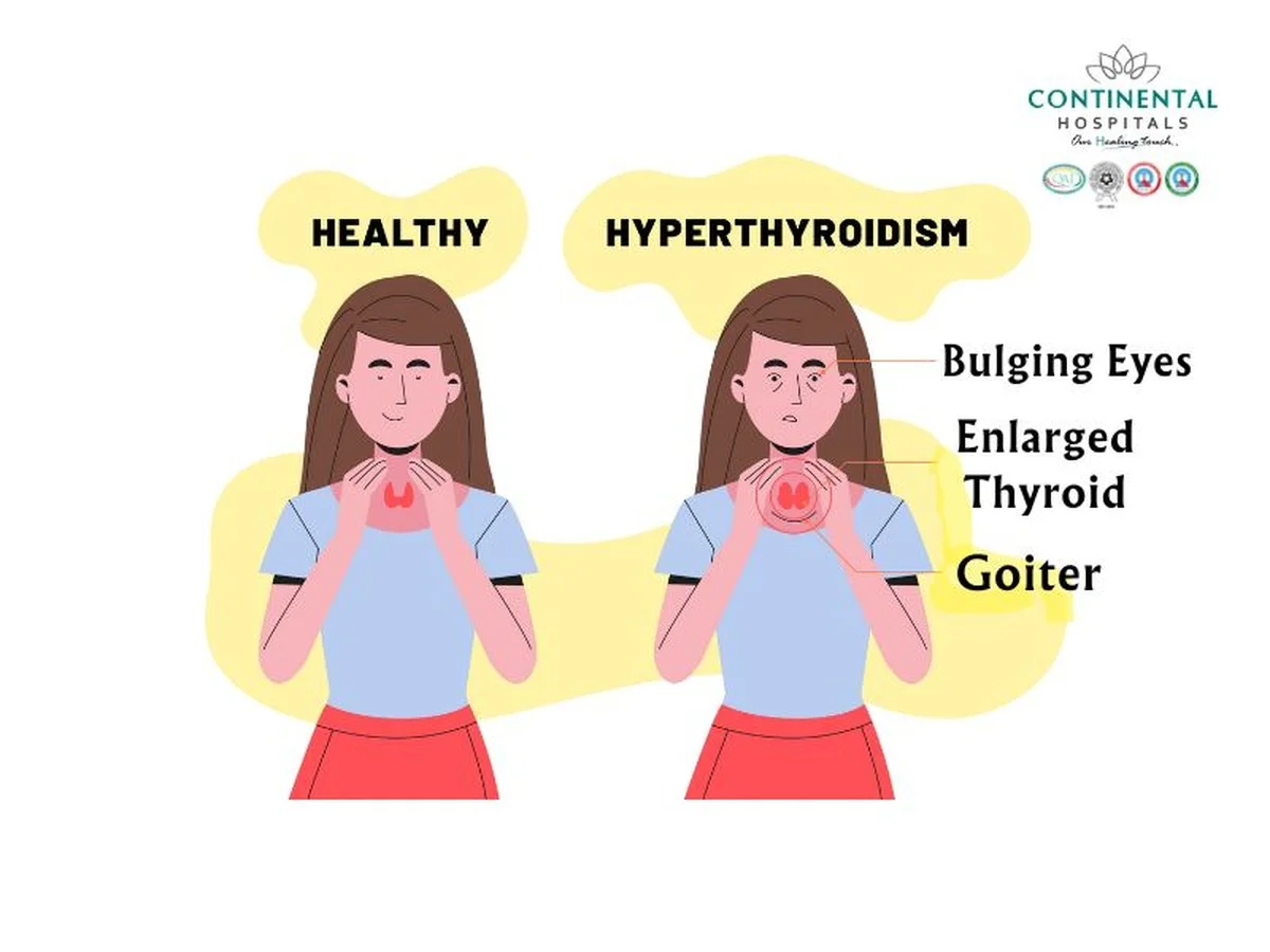 Una sencilla receta anual te ayuda a decir adiós a los problemas de tiroides - image 1