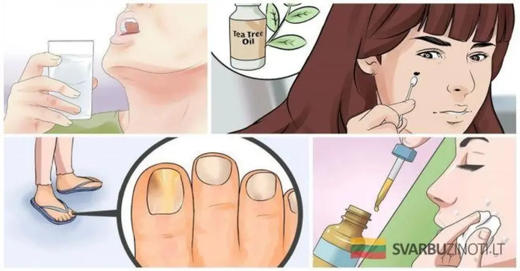 10 Usos Sorprendentes del Aceite de Árbol de Té Que Deberías Tener en Tu Botiquín