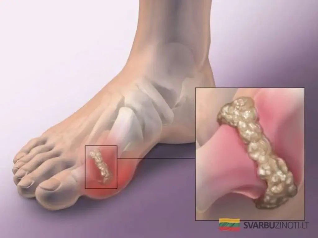 El secreto de pepino y apio para limpiar tu sangre: el jugo que elimina el ácido úrico