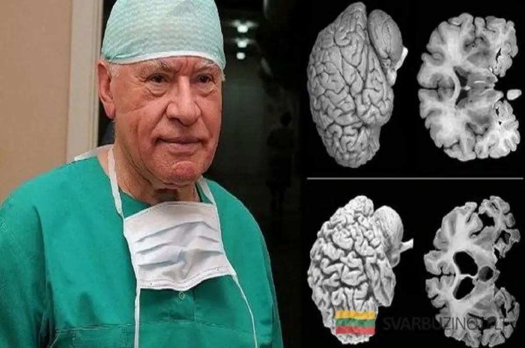 Por qué las mujeres necesitan más sueño que los hombres: El consejo que los neurólogos no quieren que ignores