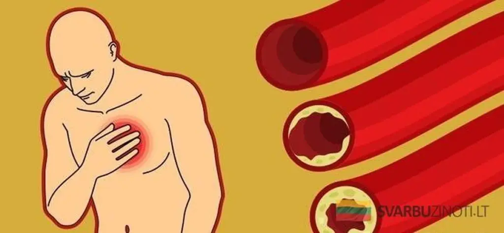 9 alimentos que limpian tus arterias de forma natural