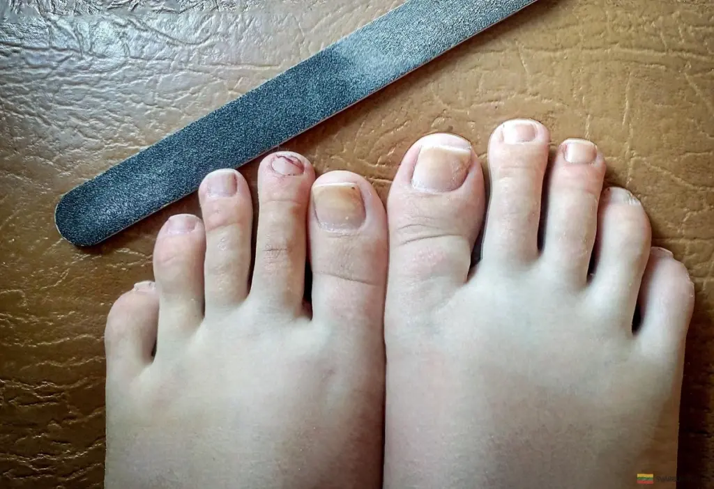 El secreto del baño de pies que deja tus uñas de los pies impecables