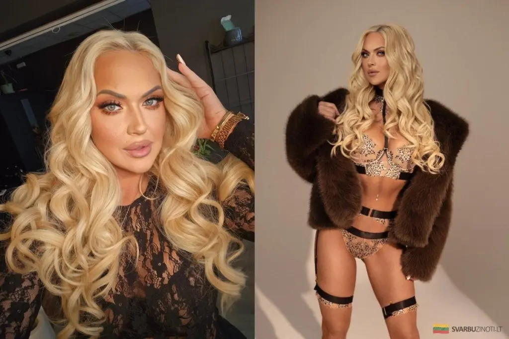 La transformación de Reveka Devolskytytė: de la pérdida de peso a la cirugía reconstructiva