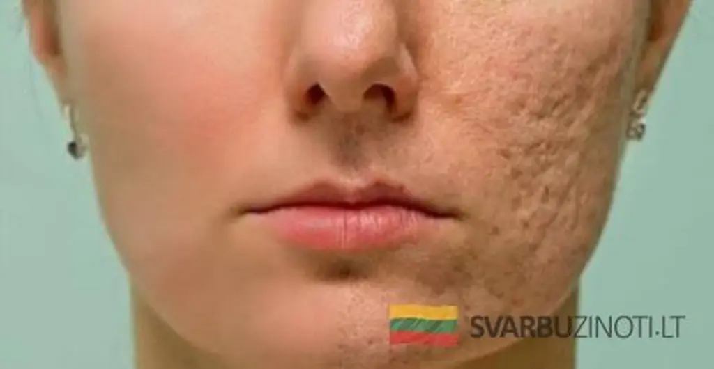 Miel para la piel: la mascarilla casera que borra arrugas y manchas en minutos