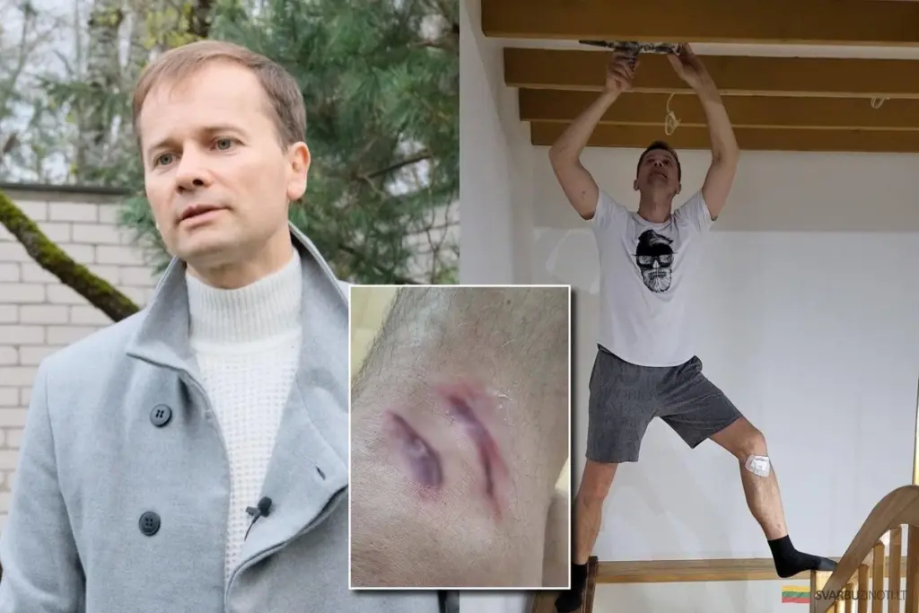 Un paso en falso en la escalera: el artista casi sufre un accidente fatal